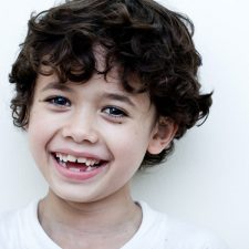 What Is the Best Solution for Missing Teeth?