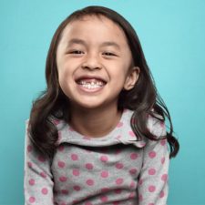 All You Need to Know About Wisdom Teeth Extraction
