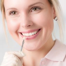Are Dental Veneers Effective in Covering Cracked and Chipped Teeth?