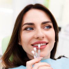 Some Facts About Dental Veneers
